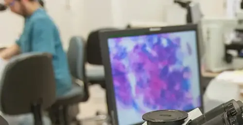 analisis-imagen-telepatologia Imagen de Análisis de imagen por telepatología. Clínica Universidad de Navarra