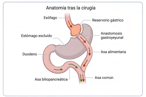 Técnica de bypass gástrico laparoscópico para el tratamiento de la obesidad.