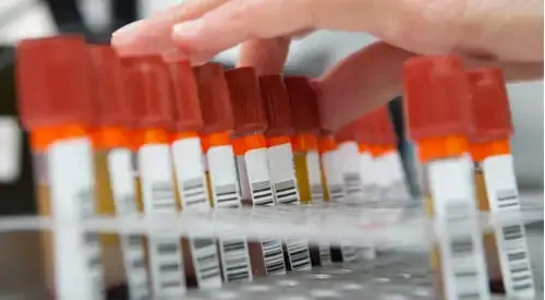img_lab_bioquimica_8 <p> Imagen Laboratorio de Bioquimica</p>