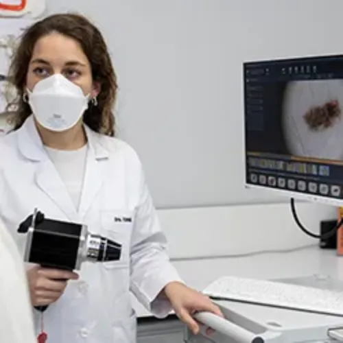 Mapeo melanoma. Clínica Universidad de Navarra Imagen de un mapeo de melanoma, Dra. Tomás del Departamento de Dermatología de la Clínica Universidad de Navarra