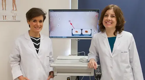 nueva-tecnica-diagnostico-melanoma <p>Las doctoras Irene Palacios y Leyre Aguado, especialistas del Departamento de Dermatología de la Clínica Universidad de Navarra junto al novedoso dispositivo que permite el diagnóstico precoz del melanoma.</p>