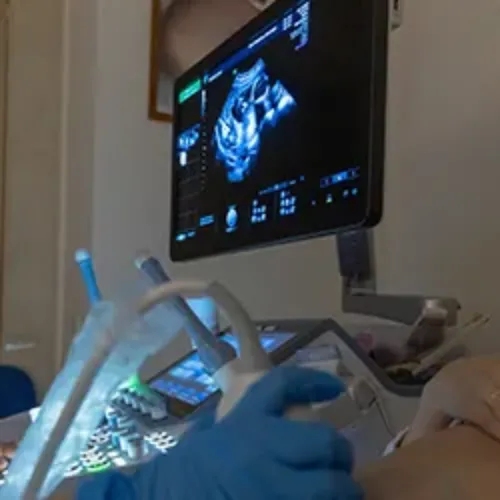 Imagen de la realización de una ecografía obstétrica de control de embarazo. Clínica Universidad de Navarra