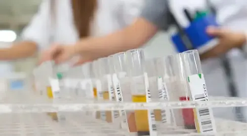 gliobastoma-ensayo-clinico-1 <p> Nuevo ensayo clínico para tratar el gliobastoma</p>
