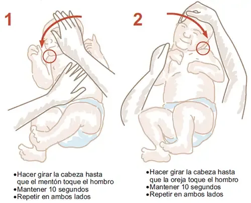 ejercicios-plagiocefalia <p>Ejercicios de estiramiento que mejoran los síntomas de la contractura muscular cervical que presentan los niños con plagiocefalia </p>