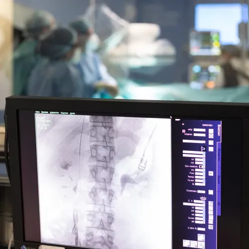 Procedimiento de Radiología Intervencionista. CUN Imagen de un procedimiento de Radiología Intervencionista de la Clínica Universidad de Navarra