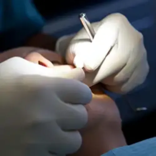 img-destacado-intervencion-unidad-dental