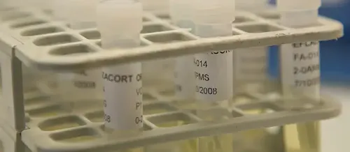 img-destacado-analisis-uic
