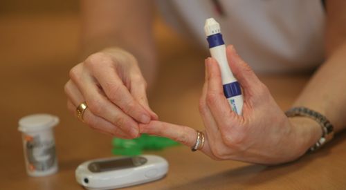 endocrinologia-facultad-medicina <p>En el hospital de día del Departamento de Endocrinología de la Clínica Universidad de Navarra se enseña al paciente a realizar el control de su glucemia </p>