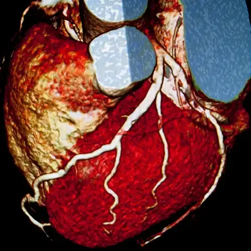 img-linea-cardiovascular