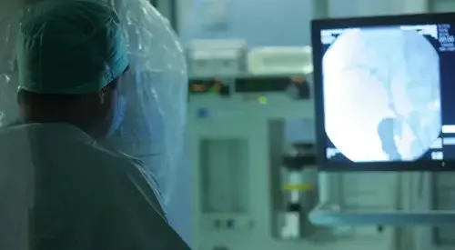 angiografia-digital <p>Angiografía digital </p>