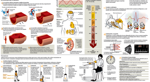 2011_img_preview_infco_HTA <p>Infográfico sobre la hipertensión arterial </p>