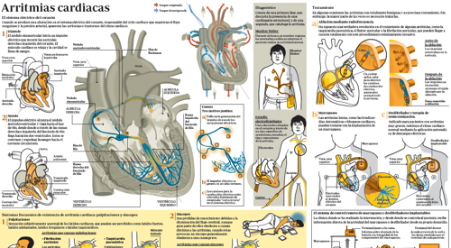 2011_img_preview_infografico_arritmias <p>Imagen preview del infográfico sobre arritmias cardiacas </p>