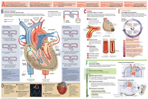 infografico-max-insuficiencia-cardiaca