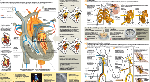 2010_img_preview_infografico_cirugia_valvular <p>Imagen preview del infográfico sobre enfermedades valvulares </p>