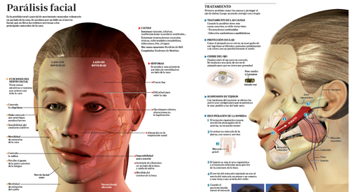 2013_img_preview_infografico_paralisis_facial <p>Imagen preview del infográfico sobre la parálisis facial </p>