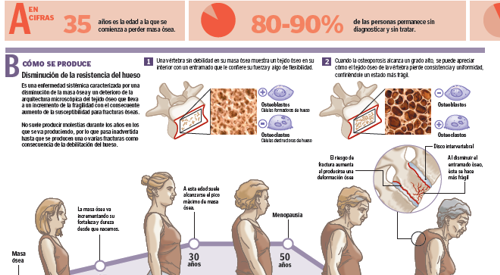 2010_img_preview_osteoporosis