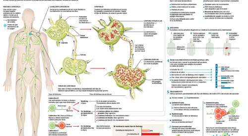 2013_img_preview_infografico_linfomas <p>Imagen preview del infográfico sobre linfomas </p>