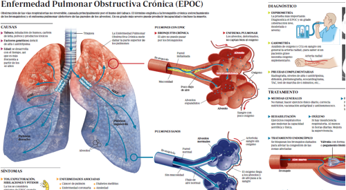 2012_img_preview_epoc