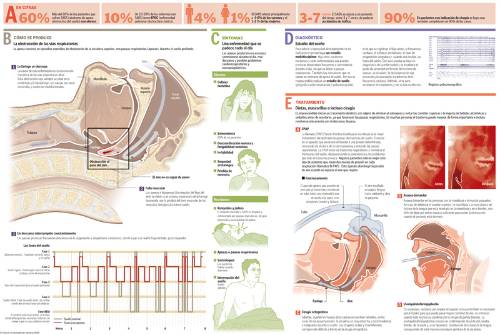 infografico-max-saos