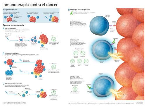 Inmunoterapia cancer que es