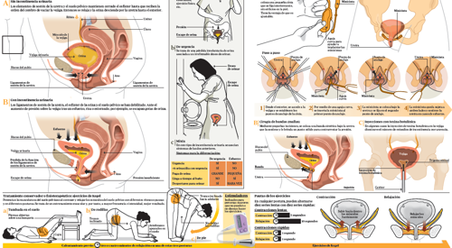 2011_img_preview_infografico_incontinencia_urinaria <p>Imagen preview del infográfico sobre incontinencia urinaria </p>