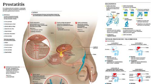 prostatitis antibiótico