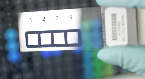 dx_microarrays <p> Diagnóstico de alergias mediante microarray</p>