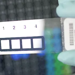 tecnicas-invitro Imagen de técnicas in vitro del Laboratorio del Departamento de Alergología de la Clínica Universidad de Navarra