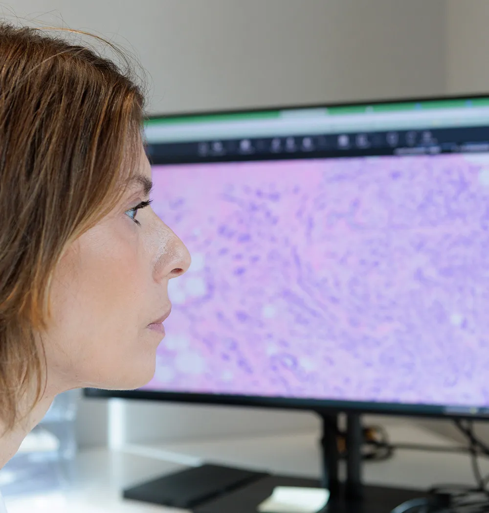 Imagen de actividad diagnóstica en anatomía patológica. Clínica Universidad de Navarra