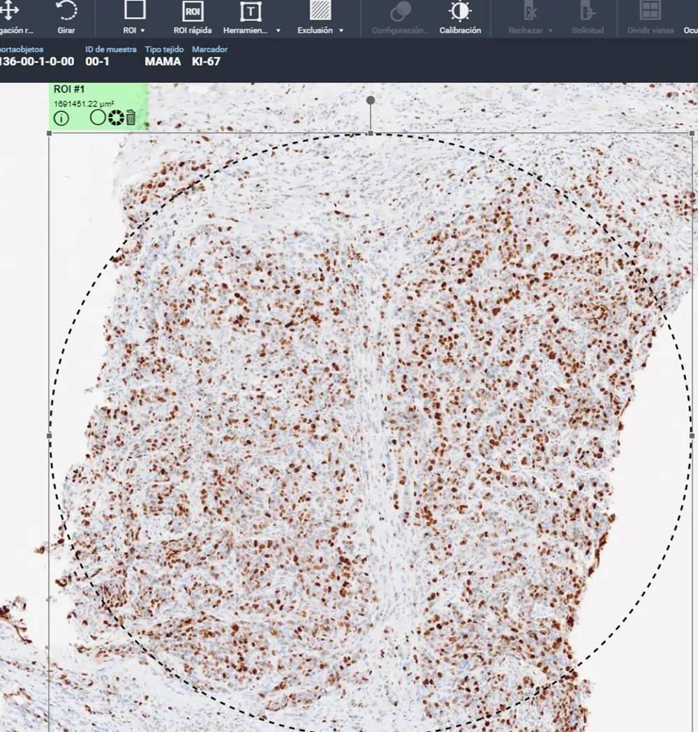 Imagen de formación integral en anatomía patológica. Clínica Universidad de Navarra