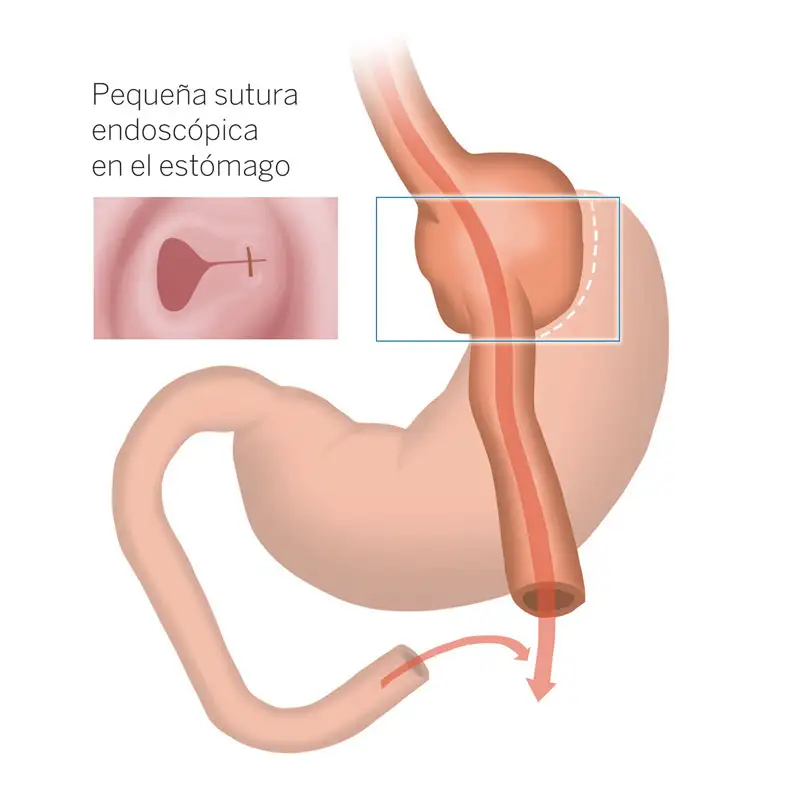 tecnica-reto