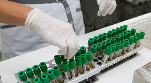 img_lab_bioquimica_12 <p>Imagen Laboratorio de Bioquimica </p>