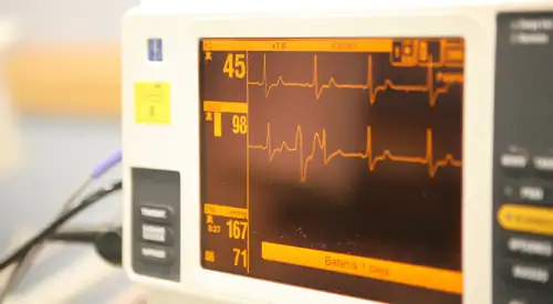 curso_electrofisiologia_cardiaca