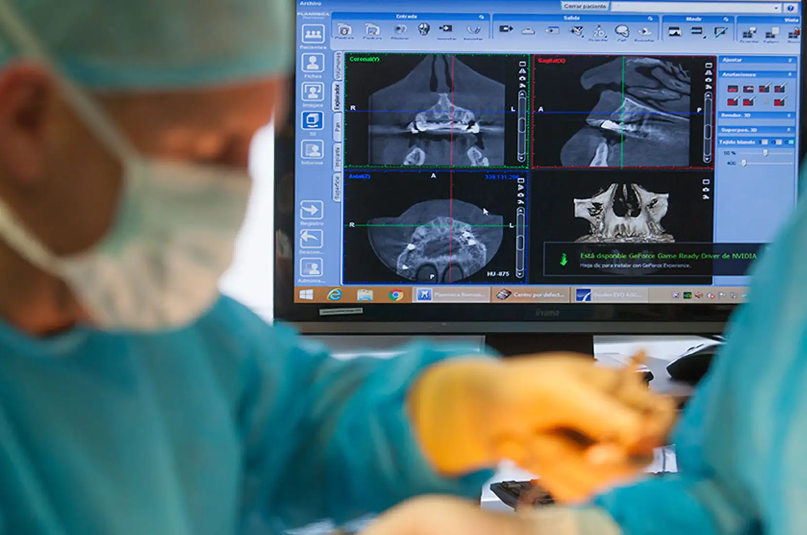 Implantes guiados por ordenador