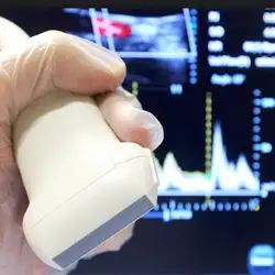 ecodoppler-varices