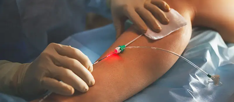 img-destacado-cirugia-vascular-3