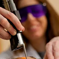 tratamiento-dermatologia Imagen de un tratamiento en Dermatología. Clínica Universidad de Navarra