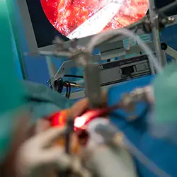 img-destacado-procedimiento-endoscopia