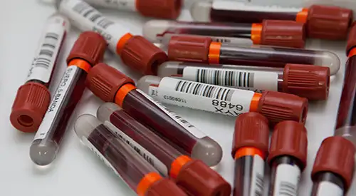 analisis-tubos-laboratorio-hematologia <p>Imagen de tubos de análisis de sangre del Laboratorio de Hematología de la Clínica Universidad de Navarra </p>