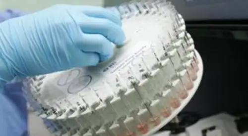 inmunologia <p>Laboratorio de inmunología </p>