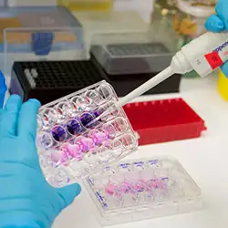 img-destacado-investigacion-neurociencias