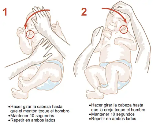 ejercicios-plagiocefalia <p>Ejercicios de estiramiento que mejoran los síntomas de la contractura muscular cervical que presentan los niños con plagiocefalia </p>