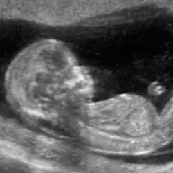 img-destacado-ecografia-obstetrica