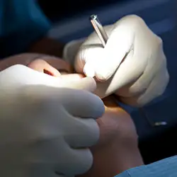 img-destacado-intervencion-unidad-dental