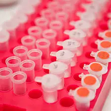 genetica-clinica Imagen de Investigación. Genética Clínica. Clínica Universidad de Navarra