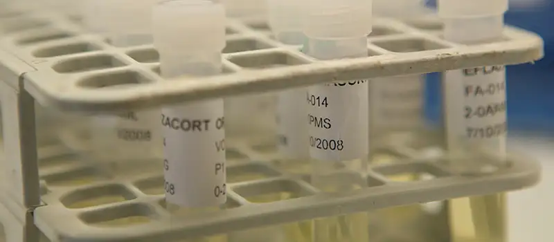 img-destacado-analisis-uic