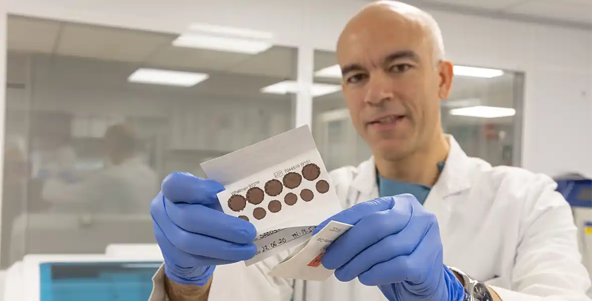 Imagen del Dr. Gabriel Reina, especialista del Servicio de Microbiología de la Clínica Universidad de Navarra, con una muestra de sangre seca.