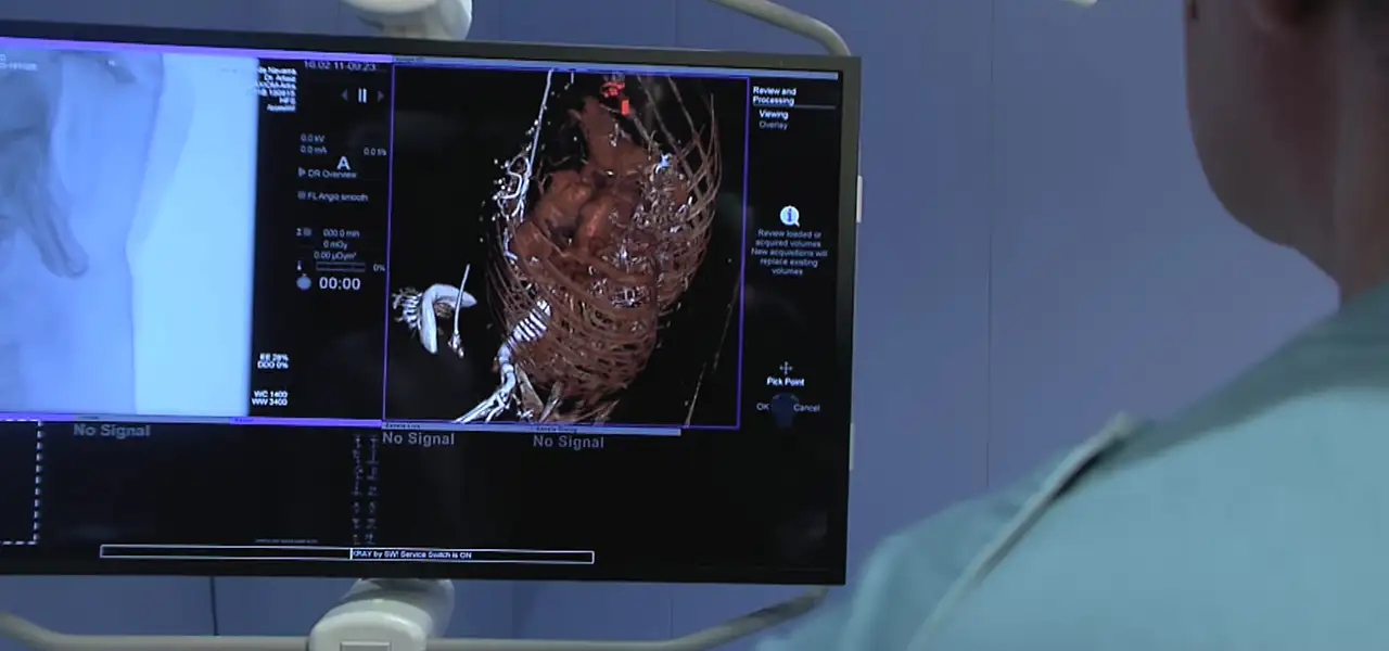 banner-cirujano-cardiaco-quirofanos-hibridos