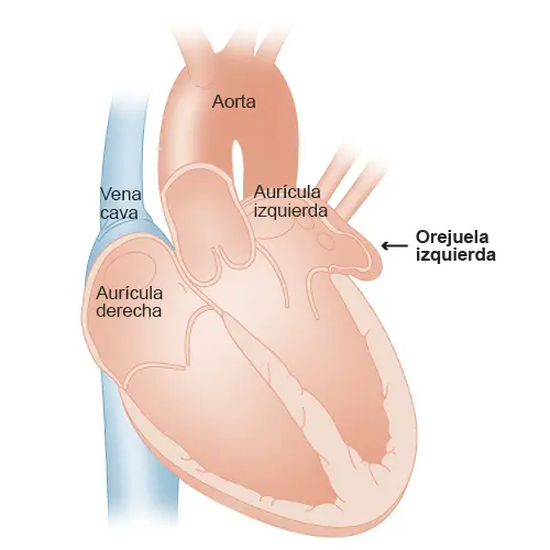 Infografía sobre la orejuela del corazón que es una pequeña estructura que se encuentra en ambas aurículas, las cámaras superiores del corazón. Estas orejuelas auriculares tienen forma de bolsa y actúan como reservorios temporales para la sangre que llega al corazón antes de ser bombeada a las cámaras inferiores, llamadas ventrículos.