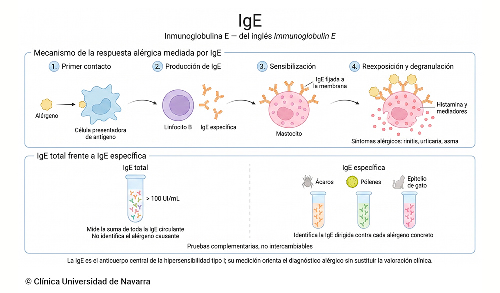 Esquema del mecanismo de la respuesta alérgica mediada por IgE en cuatro pasos (reconocimiento del alérgeno, producción de IgE por el linfocito B, sensibilización del mastocito e degranulación con liberación de histamina) y comparación visual entre IgE total e IgE específica como pruebas diagnósticas complementarias.